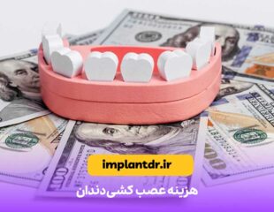 هزینه عصب کشی دندان