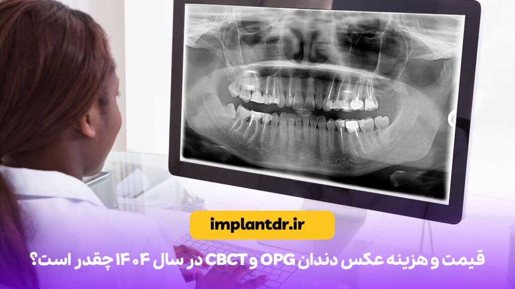هزینه عکس دندان