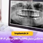 هزینه عکس دندان