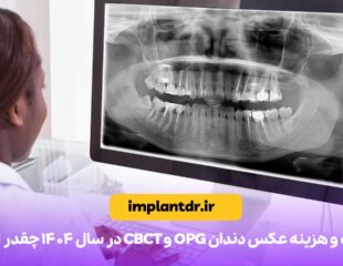 هزینه عکس دندان