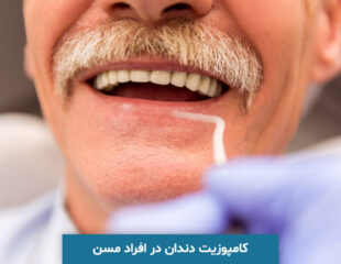 کامپوزیت دندان در افراد مسن
