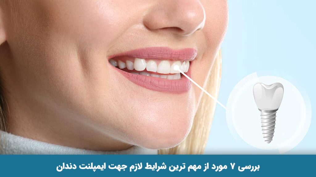 شرایط لازم جهت ایمپلنت دندان