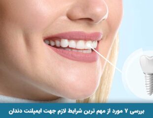 شرایط لازم جهت ایمپلنت دندان