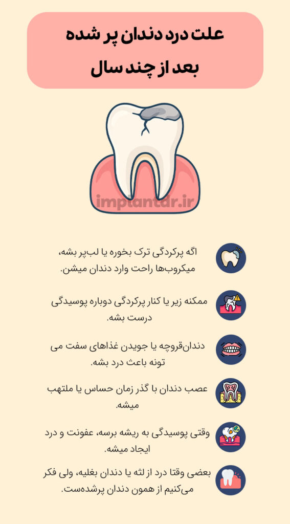 علت درد دندان پر شده بعد از چند سال