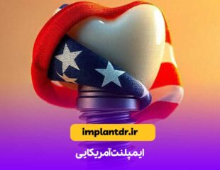 ایمپلنت آمریکایی