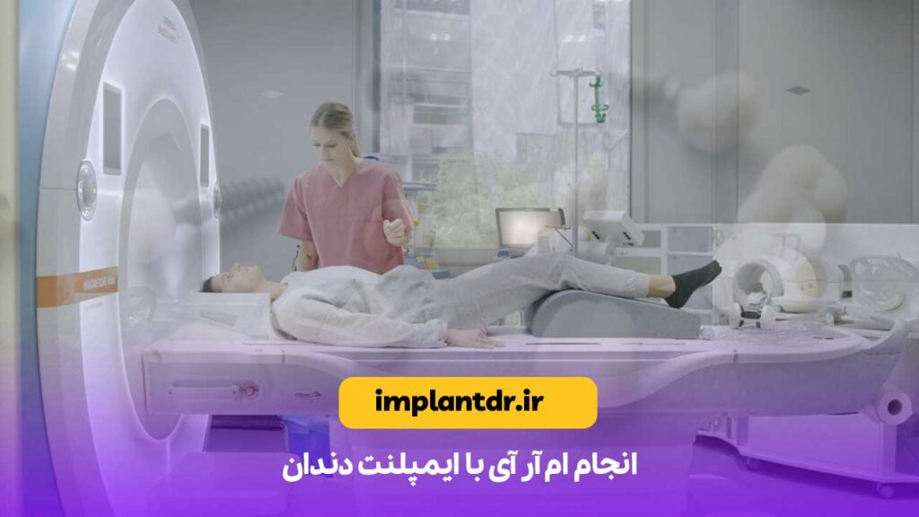 انجام ام آر آی با ایمپلنت دندان