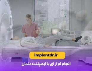انجام ام آر آی با ایمپلنت دندان