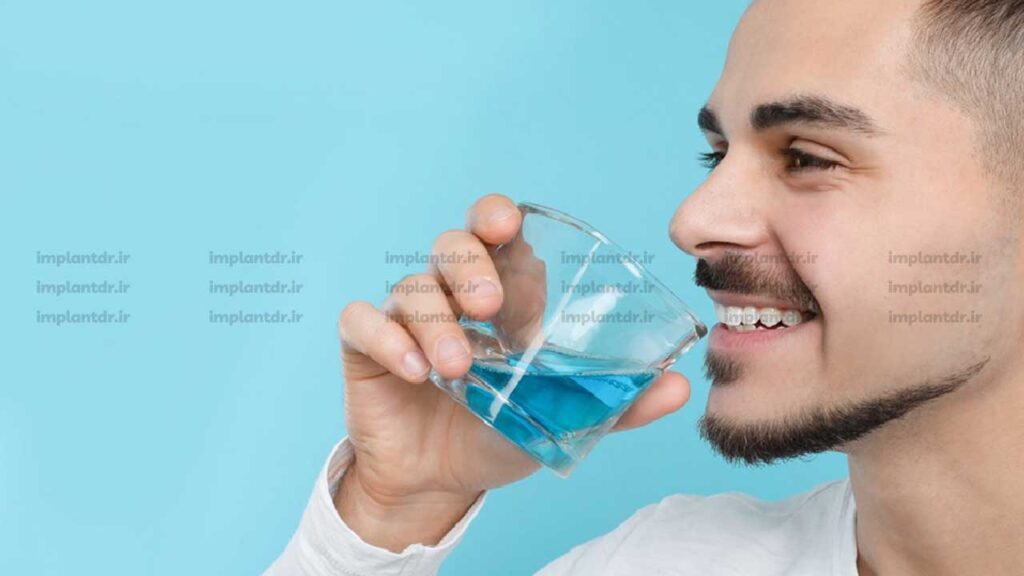 استفاده از دهانشویه بعد از ایمپلنت