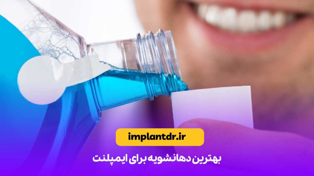 بهترین دهانشویه برای ایمپلنت