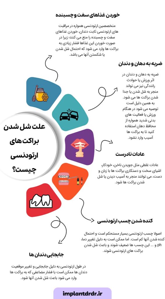 علت شل شدن براکت های ارتودنسی چیست؟