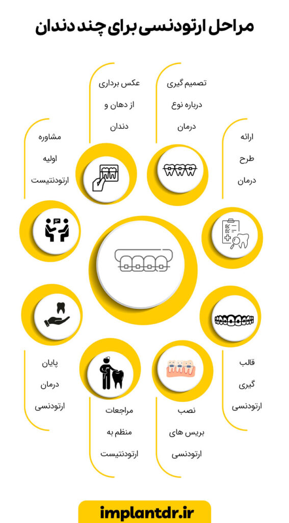 مراحل ارتودنسی برای چند دندان