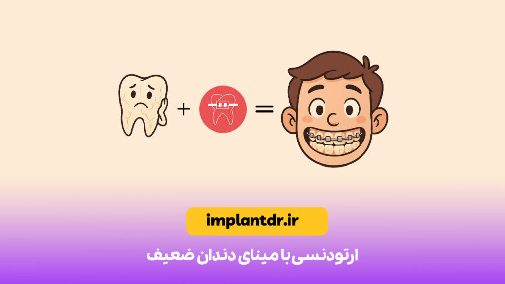 ارتودنسی با مینای دندان ضعیف