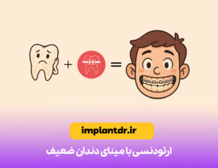 ارتودنسی با مینای دندان ضعیف