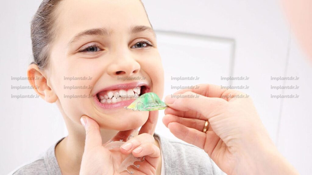 استفاده از ابزار فانکشنال برای ارتودنسی پیشگیرانه
