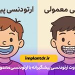 تفاوت ارتودنسی پیشگیرانه با ارتودنسی معمولی