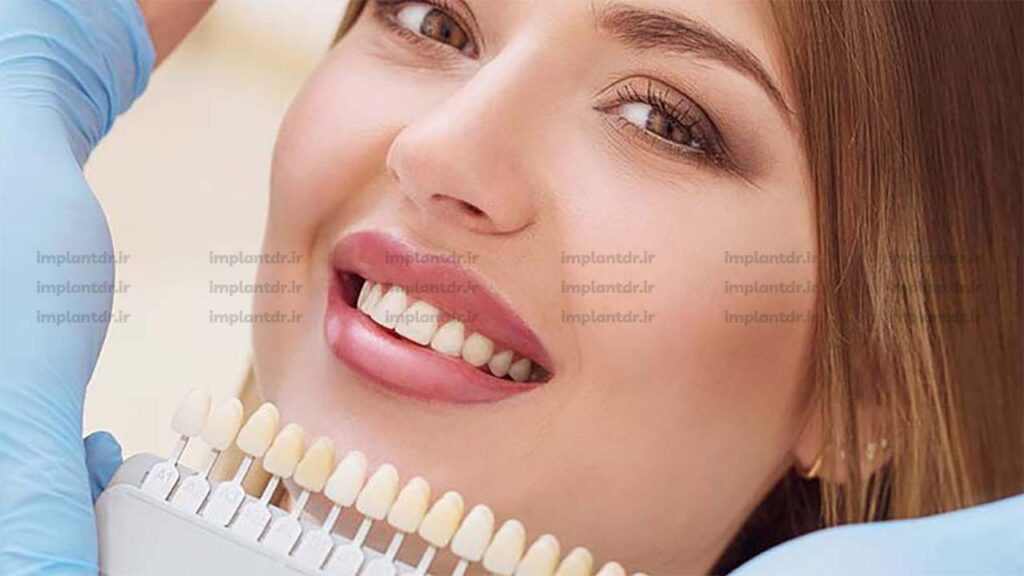 استفاده از لمینت یا اصلاح زیبایی