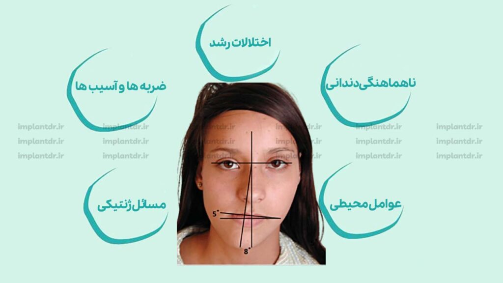 علت انحراف چانه چیست؟