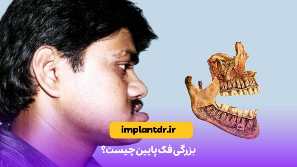 بزرگی فک پایین چیست؟