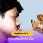 بزرگی فک پایین چیست؟