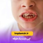 اپن بایت یک‌ طرفه