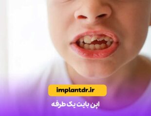 اپن بایت یک‌ طرفه