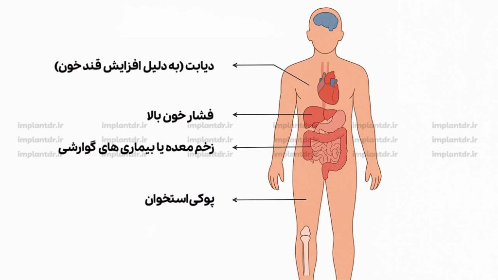 موارد منع مصرف دگزامتازون