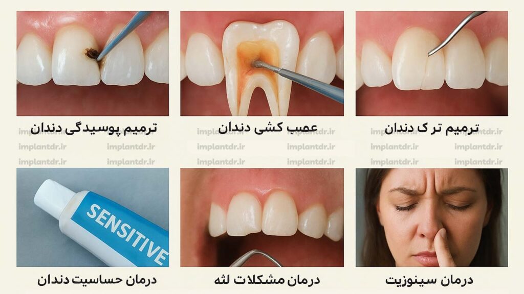روش های درمان تیر کشیدن دندان
