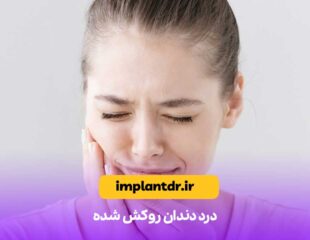 درد دندان روکش شده