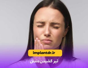 تیر کشیدن دندان