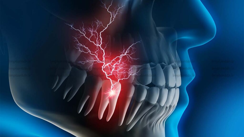 تیر کشیدن دندان چه معنایی دارد؟