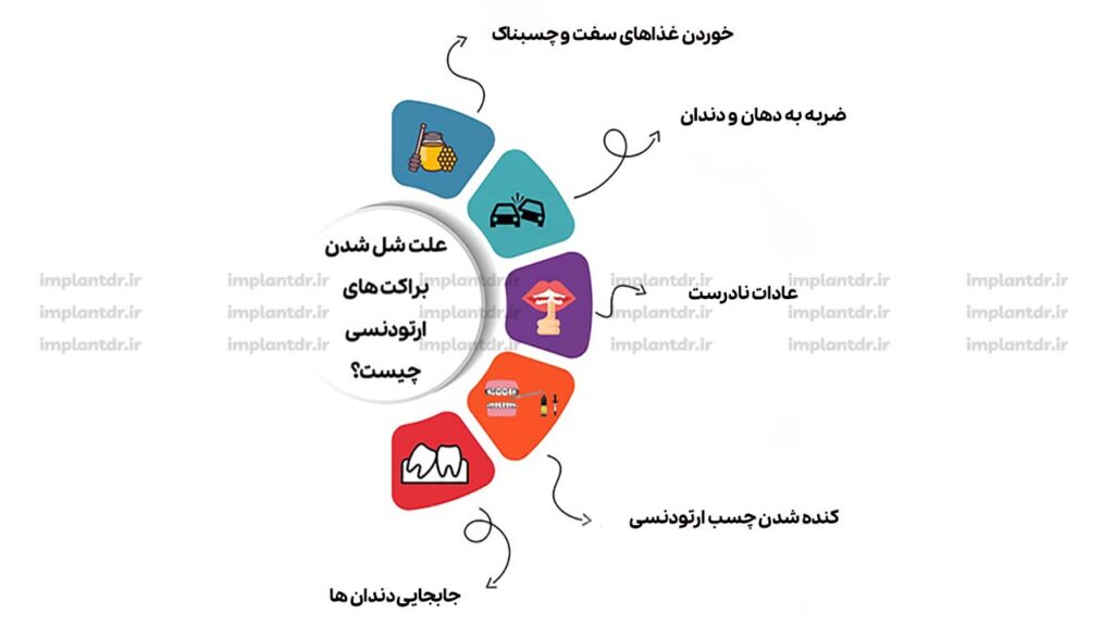 علت شل شدن براکت های ارتودنسی چیست؟