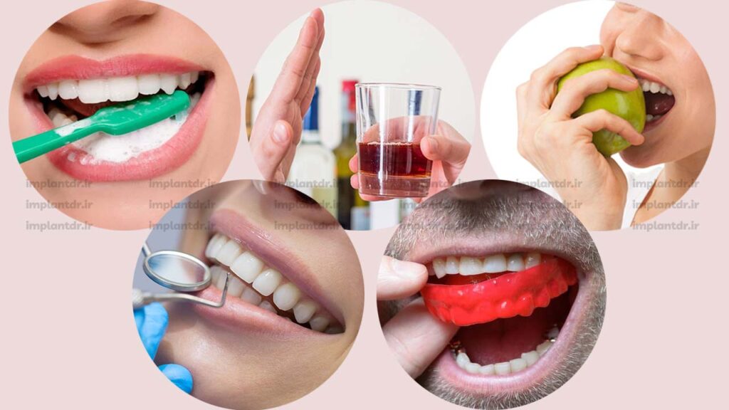 مراقبت های بعد از انجام کامپوزیت