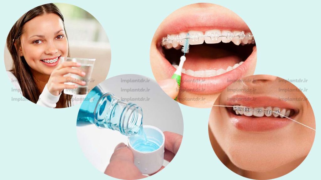 جایگزین های مناسب برای آدامس