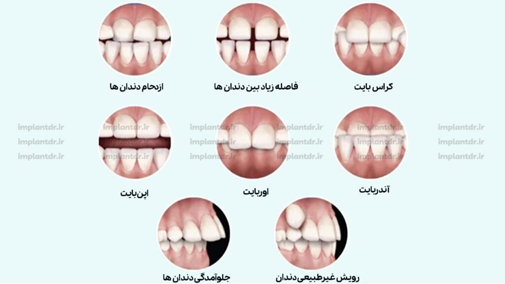 کدام یک از مشکلات دهان و دندان با ارتودنسی درمان می شوند؟