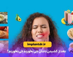 بعد از کشیدن دندان چی بخوریم چی نخوریم؟