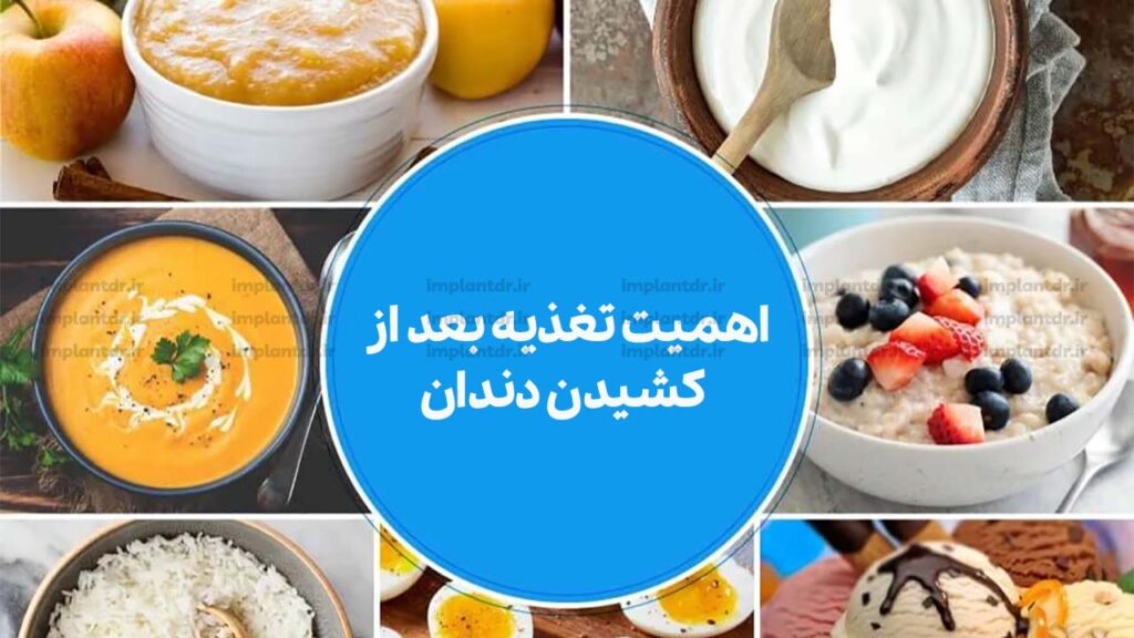 تغذیه بعد از کشیدن دندان