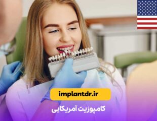 کامپوزیت آمریکایی