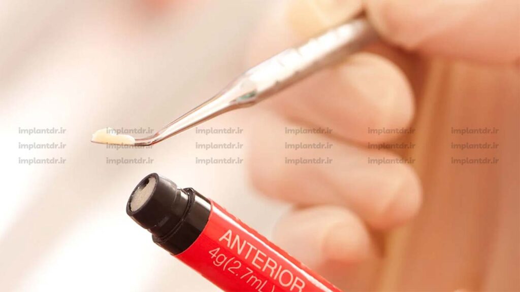 کامپوزیت آمریکایی چیست؟