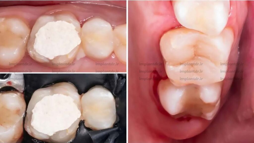 ترمیم دندان
